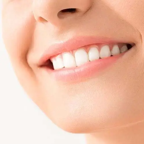 Close-up of a bright smile after teeth whitening at Ozone Beauty & Medi Spa