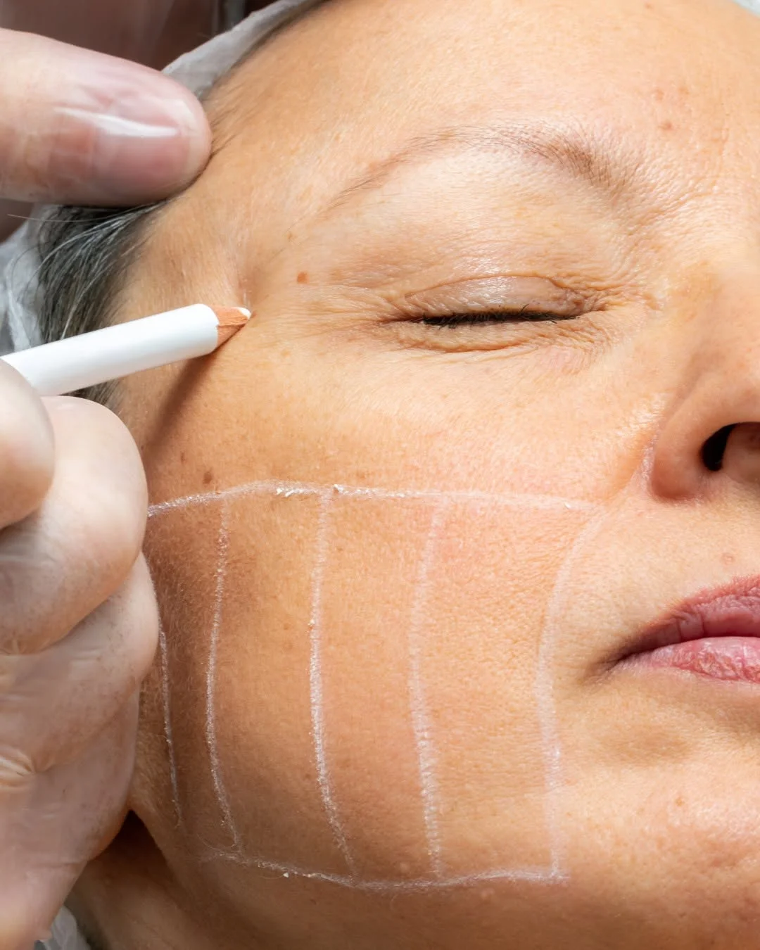 Ozone Beauty & Medi Spa services overview